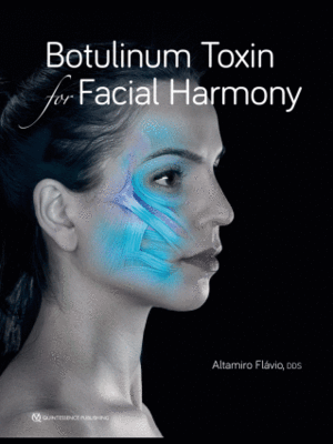 BOTULINUM TOXIN FOR FACIAL HARMONY