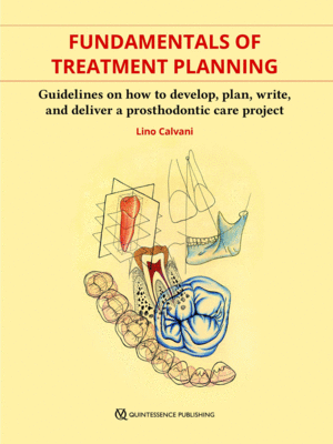 FUNDAMENTALS OF TREATMENT PLANNING. GUIDELINES ON HOW TO DEVELOP, PLAN, WRITE, AND DELIVER A PROSTHODONTIC CARE PROJECT