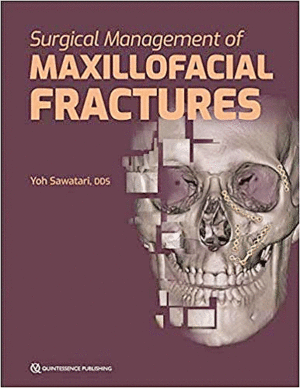 SURGICAL MANAGEMENT OF MAXILLOFACIAL FRACTURES