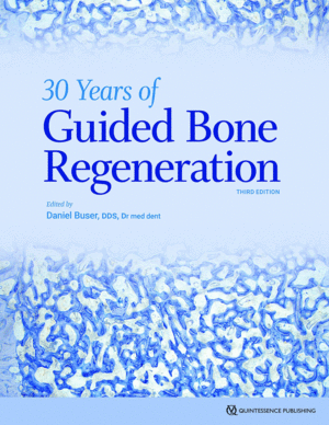 30 YEARS OF GUIDED BONE REGENERATION. 3RD EDITION