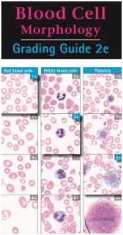 BLOOD CELL MORPHOLOGY GRADING GUIDE. 2ND EDITION