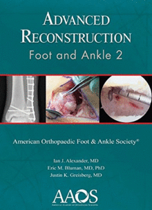 ADVANCED RECONSTRUCTION: FOOT AND ANKLE 2