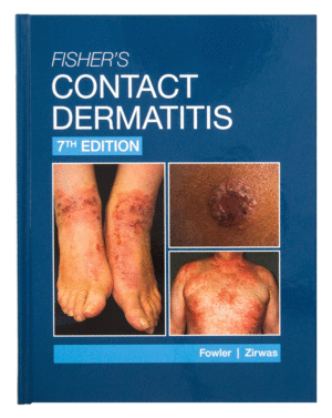FISHER'S CONTACT DERMATITIS. 7TH EDITION