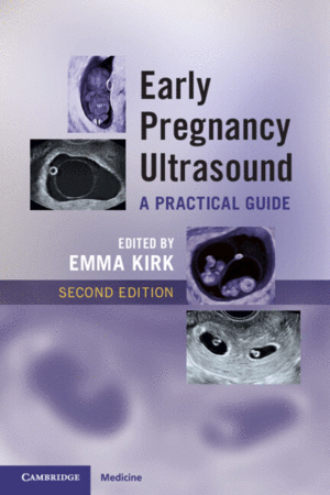 EARLY PREGNANCY ULTRASOUND. A PRACTICAL GUIDE. 2ND EDITION