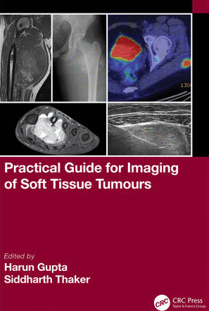 PRACTICAL GUIDE FOR IMAGING OF SOFT TISSUE TUMOURS