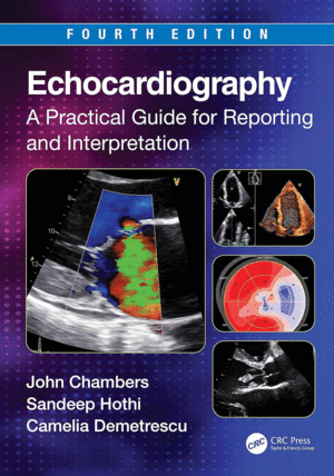 ECHOCARDIOGRAPHY. A PRACTICAL GUIDE FOR REPORTING AND INTERPRETATION. 4TH EDITION