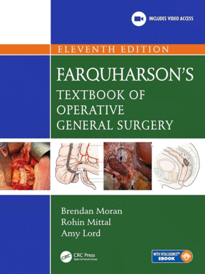 FARQUHARSON'S TEXTBOOK OF OPERATIVE GENERAL SURGERY. 11TH EDITION