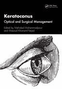 KERATOCONUS. OPTICAL AND SURGICAL MANAGEMENT