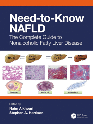 NEED-TO-KNOW NAFLD THE COMPLETE GUIDE TO NONALCOHOLIC FATTY LIVER DISEASE