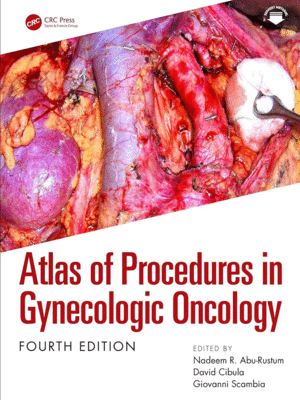 ATLAS OF PROCEDURES IN GYNECOLOGIC ONCOLOGY. 4TH EDITION