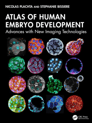 ATLAS OF HUMAN EMBRYO DEVELOPMENT. ADVANCES WITH NEW IMAGING TECHNOLOGIES