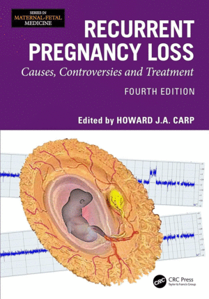 RECURRENT PREGNANCY LOSS. CAUSES, CONTROVERSIES AND TREATMENT. 4TH EDITION