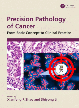 PRECISION PATHOLOGY OF CANCER. FROM BASIC CONCEPT TO CLINICAL PRACTICE