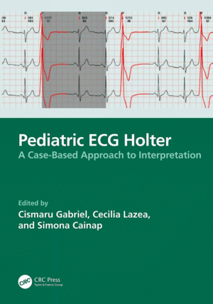 PEDIATRIC ECG HOLTER. A CASE-BASED APPROACH TO INTERPRETATION