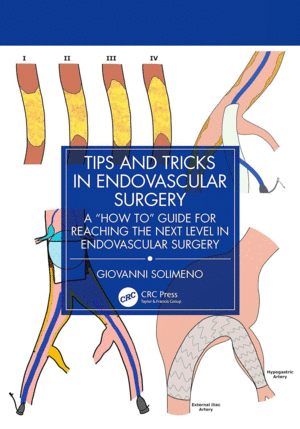 TIPS AND TRICKS IN ENDOVASCULAR SURGERY. A HOW TO GUIDE FOR REACHING THE NEXT LEVEL IN ENDOVASCULAR SURGERY