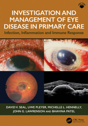 INVESTIGATION & MANAGEMENT OF EYE DISEASE IN PRIMARY CARE: INFECTION, INFLAMMATION AND IMMUNE RESPONSE