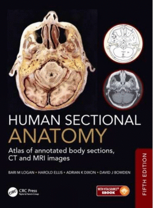 HUMAN SECTIONAL ANATOMY ATLAS OF ANNOTATED BODY SECTIONS, CT AND MRI IMAGES. 5TH EDITION
