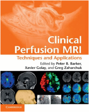 CLINICAL PERFUSION MRI. TECHNIQUES AND APPLICATIONS