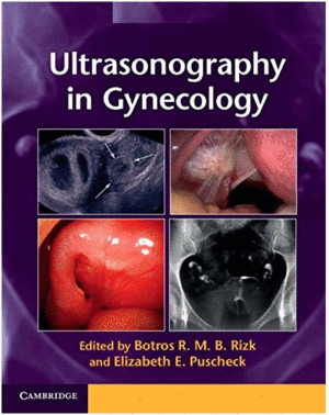 ULTRASONOGRAPHY IN GYNECOLOGY