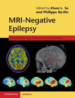 MRI-NEGATIVE EPILEPSY. EVALUATION AND SURGICAL MANAGEMENT