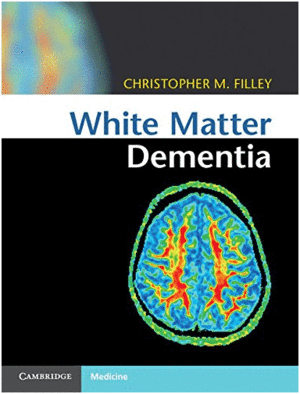 WHITE MATTER DEMENTIA