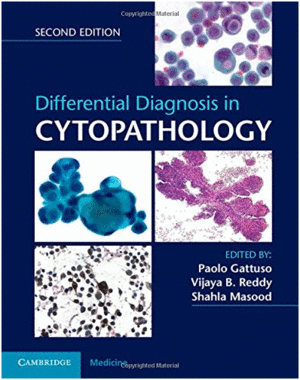 DIFFERENTIAL DIAGNOSIS IN CYTOPATHOLOGY. 2ND EDITION