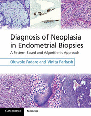 DIAGNOSIS OF NEOPLASIA IN ENDOMETRIAL BIOPSIES. A PATTERN-BASED AND ALGORITHMIC APPROACH. BOOK AND ONLINE BUNDLE