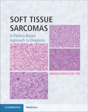 SOFT TISSUE SARCOMAS. A PATTERN-BASED APPROACH TO DIAGNOSIS HARDBACK WITH ONLINE RESOURCE