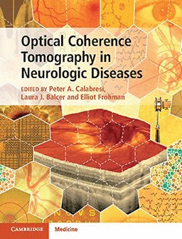 OPTICAL COHERENCE TOMOGRAPHY IN NEUROLOGIC DISEASES