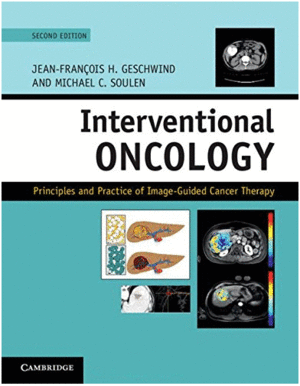 INTERVENTIONAL ONCOLOGY. PRINCIPLES AND PRACTICE OF IMAGE-GUIDED CANCER THERAPY. 2ND EDITION