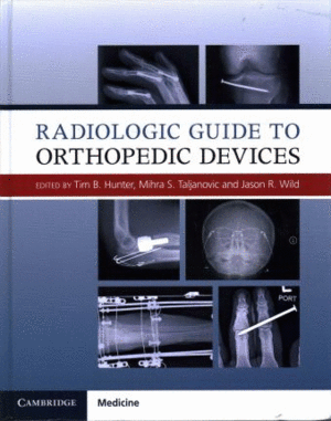 RADIOLOGIC GUIDE TO ORTHOPEDIC DEVICES