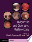 DIAGNOSTIC AND OPERATIVE HYSTEROSCOPY