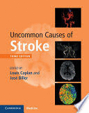 UNCOMMON CAUSES OF STROKE. 3RD EDITION