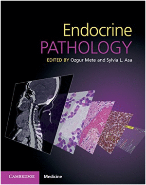 ENDOCRINE PATHOLOGY. WITH ONLINE RESOURCE