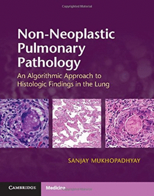 NON-NEOPLASTIC PULMONARY PATHOLOGY. AN ALGORITHMIC APPROACH TO HISTOLOGIC FINDINGS IN THE LUNG. WITH ONLINE RESOURCE