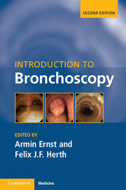 INTRODUCTION TO BRONCHOSCOPY. 2ND EDITION
