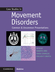 CASE STUDIES IN MOVEMENT DISORDERS. COMMON AND UNCOMMON PRESENTATIONS
