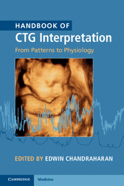 HANDBOOK OF CTG INTERPRETATION. FROM PATTERNS TO PHYSIOLOGY