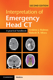 INTERPRETATION OF EMERGENCY HEAD CT. A PRACTICAL HANDBOOK. 2ND EDITION