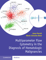 MULTIPARAMETER FLOW CYTOMETRY IN THE DIAGNOSIS OF HEMATOLOGIC MALIGNANCIES