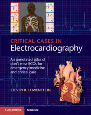 CRITICAL CASES IN ELECTROCARDIOGRAPHY. AN ANNOTATED ATLAS OF DONT-MISS ECGS FOR EMERGENCY AND CRITI