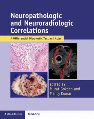 NEUROPATHOLOGIC AND NEURORADIOLOGIC CORRELATIONS. A DIFFERENTIAL DIAGNOSTIC TEXT AND ATLAS