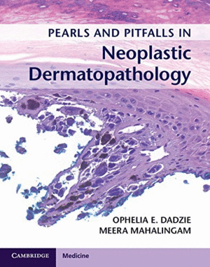 PEARLS AND PITFALLS IN NEOPLASTIC DERMATOPATHOLOGY. WITH ONLINE ACCESS