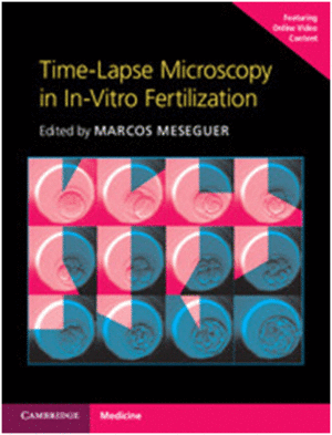 TIME-LAPSE MICROSCOPY IN IN-VITRO FERTILIZATION. TIME-LAPSE MICROSCOPY IN IN-VITRO FERTILIZATION
