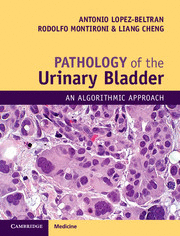 PATHOLOGY OF THE URINARY BLADDER. AN ALGORITHMIC APPROACH. PRINT/ONLINE BUNDLE.