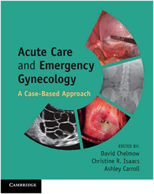 ACUTE CARE AND EMERGENCY GYNECOLOGY. A CASE-BASED APPROACH