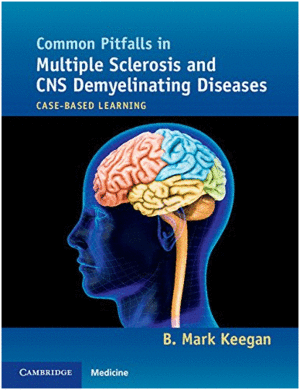 COMMON PITFALLS IN MULTIPLE SCLEROSIS AND CNS DEMYELINATING DISEASES. CASE-BASED LEARNING