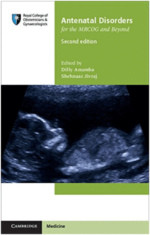 ANTENATAL DISORDERS FOR THE MRCOG AND BEYOND. 2ND EDITION