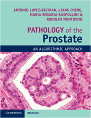 PATHOLOGY OF THE PROSTATE. AN ALGORITHMIC APPROACH