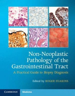 NON-NEOPLASTIC PATHOLOGY OF THE GASTROINTESTINAL TRACT. A PRACTICAL GUIDE TO BIOPSY DIAGNOSIS WITH ONLINE RESOURCE